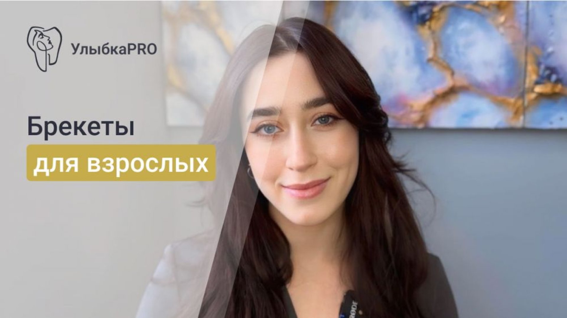 Брекеты для взрослых Почему никогда не поздно исправить свою улыбку