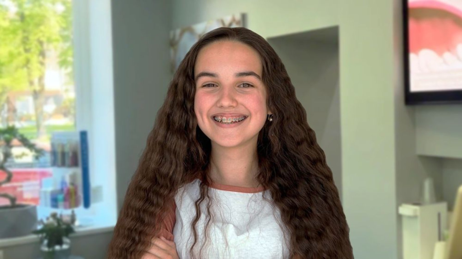 Лечение на брекетах - 11 000 рублей в месяц