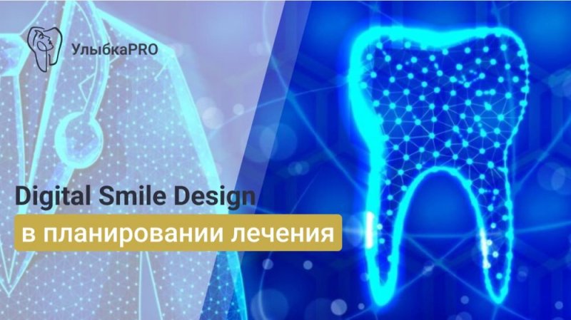 Как мы планируем вашу будущую улыбку с помощью Smile Design и других цифровых технологий?