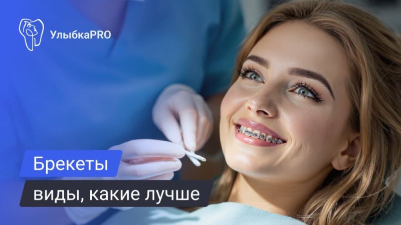 Брекеты: виды, отличия и советы по выбору от ортодонта