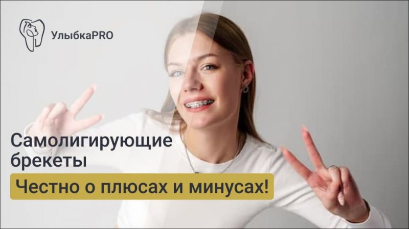 Самолигирующие брекеты: плюсы и минусы