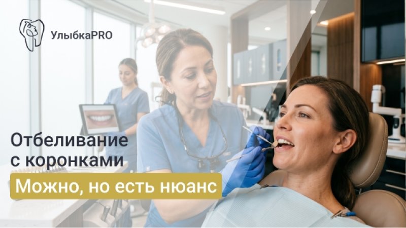 Отбеливание зубов с коронками и винирами: что важно знать перед процедурой