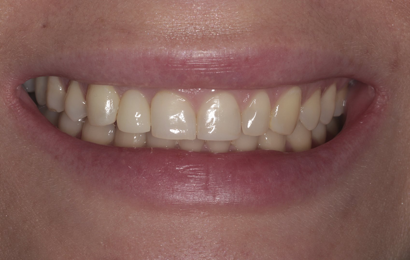 Комплексное ортопедическое и хирургическое лечение